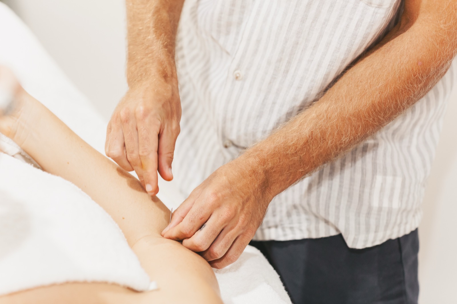Acupuncture treatment at the Paradise Point clinic